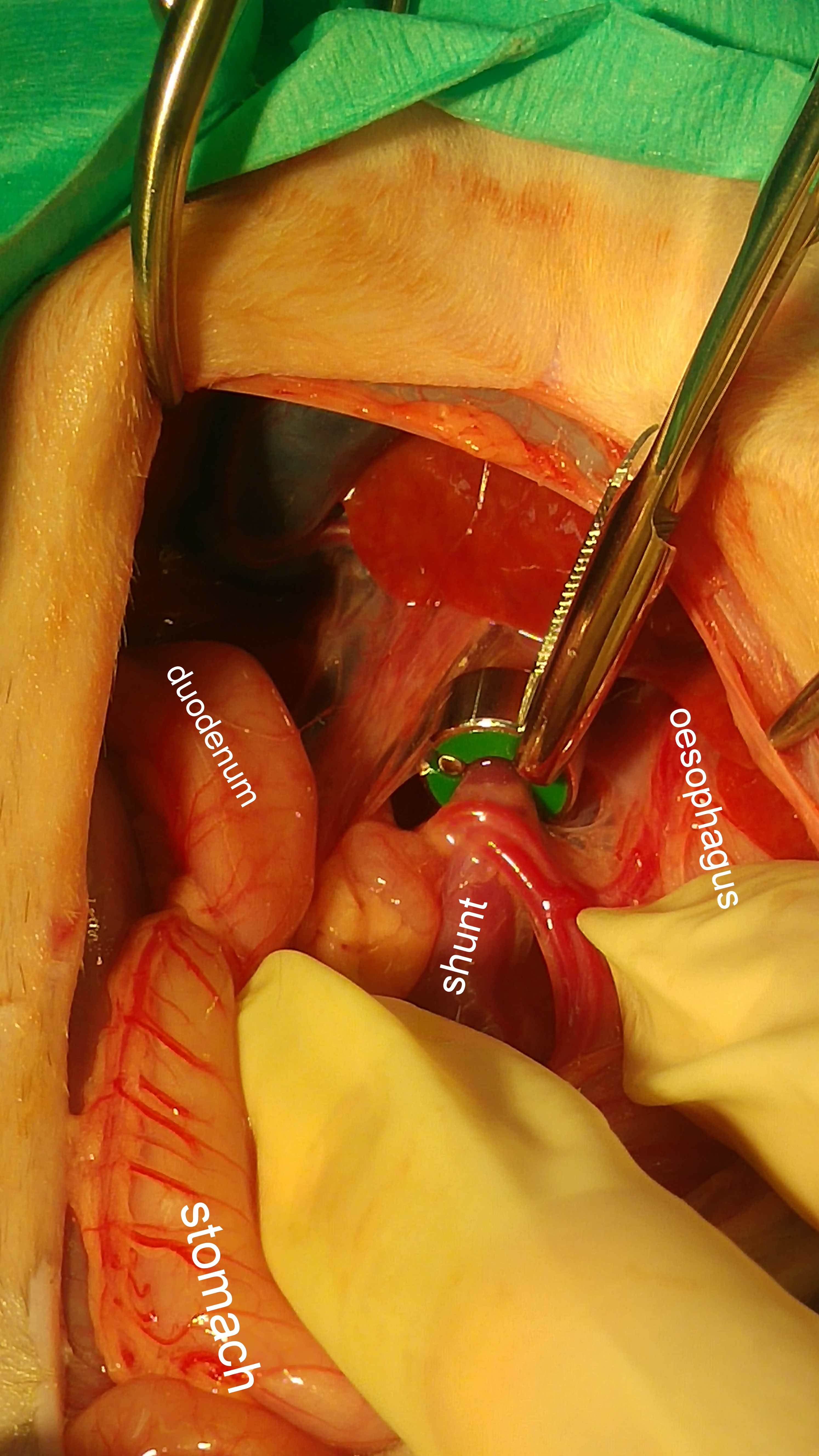 shunt-at-surgery-ventral-view