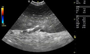 splenic torsion hyperechoic hilar spleen ultrasonographic