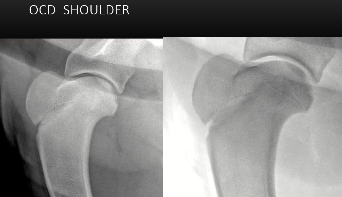 Sonographic features of canine shoulder osteochondrosis (OCD) Vet