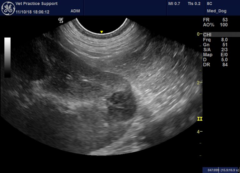 Persistent cutaneous flushing associated with presumed renal neoplasia