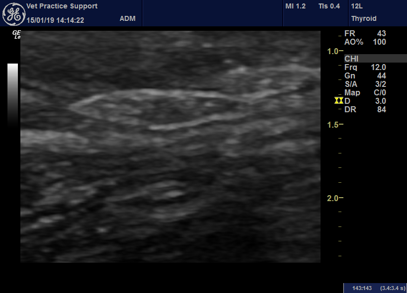Grass seed foreign bodies sonography and ultrasoundguided retrieval