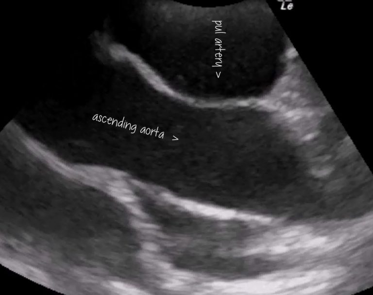 Canine patent ductus arteriosus (PDA) echocardiography – Vet Practice ...