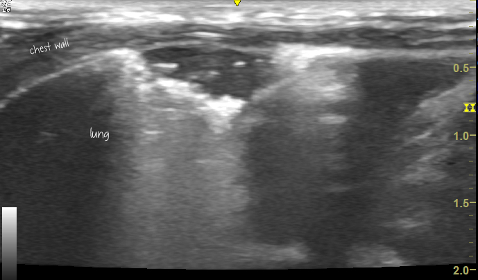 ‘Renal FIP’: sonographic features – Vet Practice Support