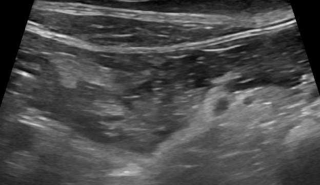 Picture of Delayed sonographic changes in acute feline pancreatitis – Vet Practice ...