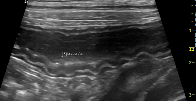Enteritis after transiting foreign body in a dog – Vet Practice Support